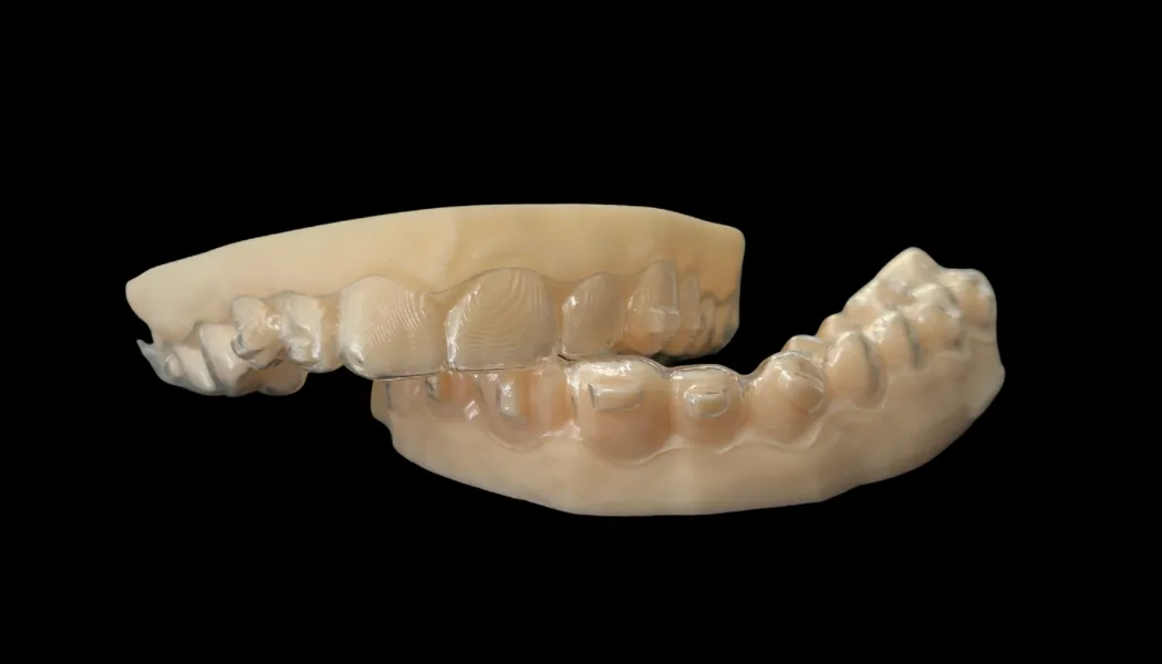 Şeffaf Plak Tedavisi